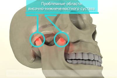 Боль в правом челюстном суставе - причины, симптомы и лечение